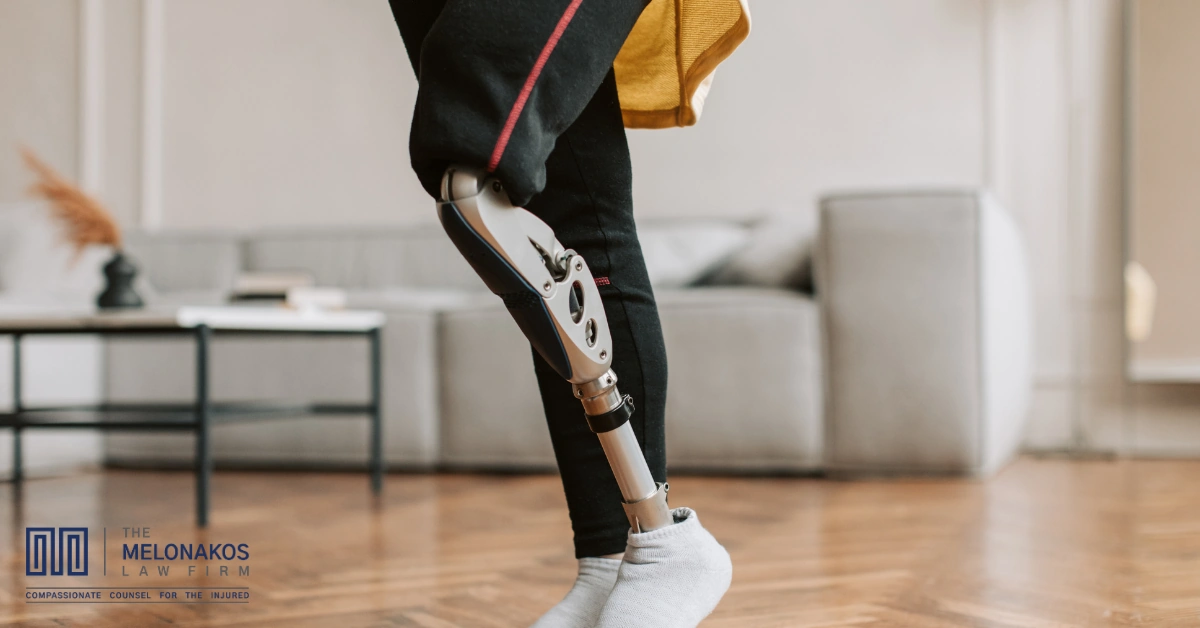 Greenville amputation injury lawyer helping a client with limb loss recovery
